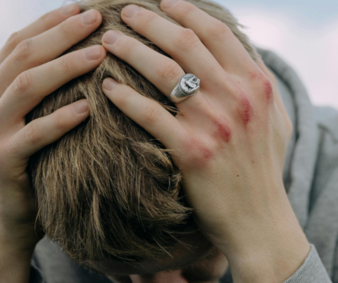 a young man holding his hands across his head